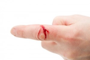 Глубокий порез пальца ножом: что делать экстренно