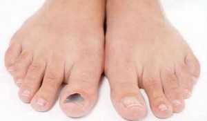 Как проявляется ушиб пальца на ноге