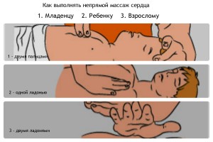 Правила выполнения массажа